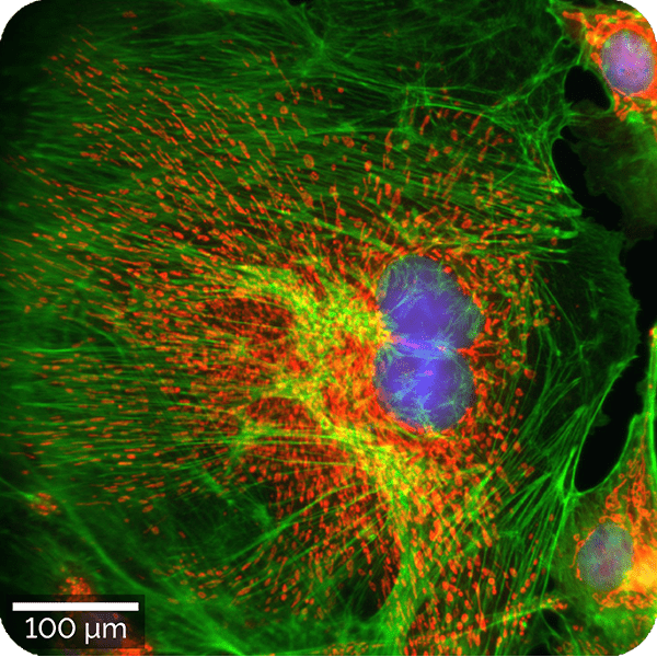Fluorescence microscopy