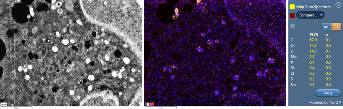 EDS mapping of a cell stained with Uranyl acetate