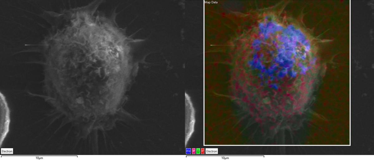 Secondary electron image of a macrophage