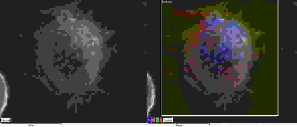 Secondary electron image of a macrophage
