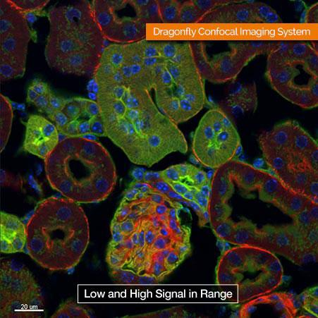 Dragonfly confocal image