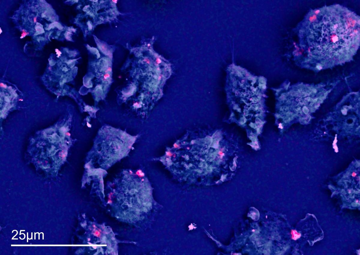 Layered EDS map showing the localisation of cobalt nanoparticles in macrophages