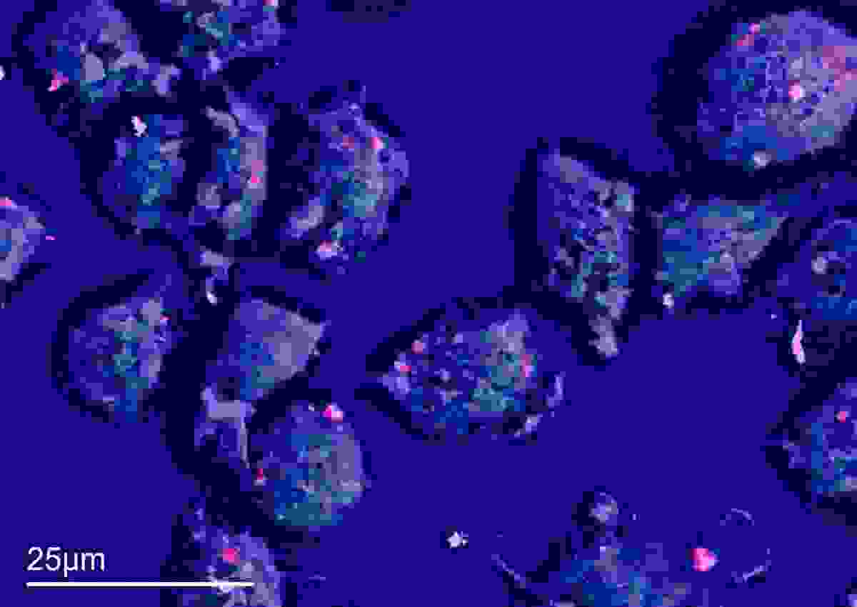 Layered EDS map showing the localisation of cobalt nanoparticles in macrophages