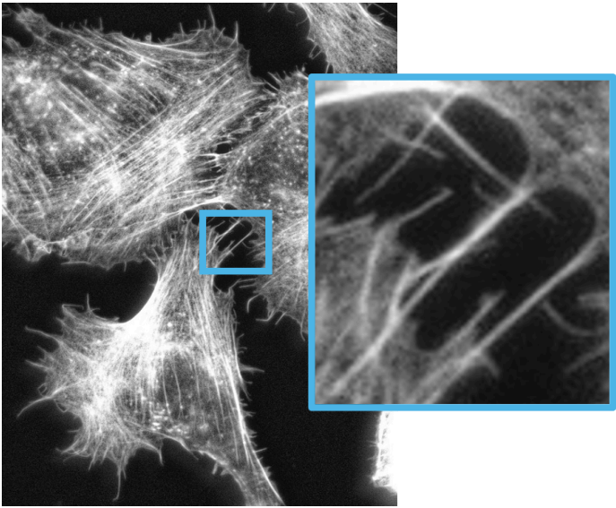 High resolution fluorescence image of U2-OS cells labeled with phalloidin-AlexiaFluo 568 (actin)