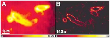 Figure 2: Imaging E. coli Conventional (A) and PALMIRA (B) image of a 200 nm thick cryosection of cytoplasmic membrane labelled E. coli (from: A. Egner et al., Biophys J, 2007)