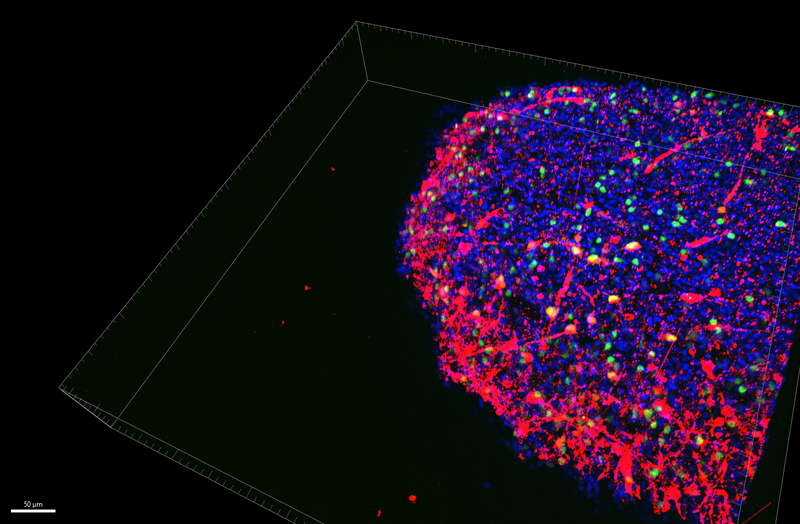 Human brain organoid