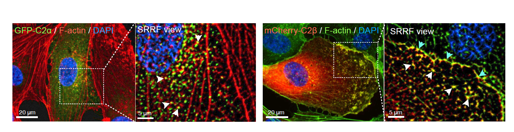 mCherry-C2β localizes with F-actin at the cell membrane