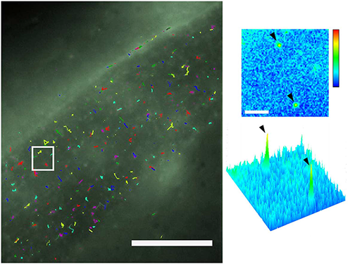 Single-molecule tracking of CD4-split-GFP on muscle cells by dCALM and CALM sp-FRET