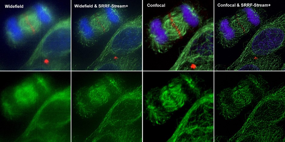 Comparison between different imaging modes (widefield and Confocal) with and without SRRF-Stream+