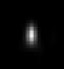 Comparison of imaging performance with the Dragonfly in widefield and confocal with 40 μm pinhole before and after deconvolution