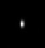 Comparison of imaging performance with the Dragonfly in widefield and confocal with 40 μm pinhole before and after deconvolution