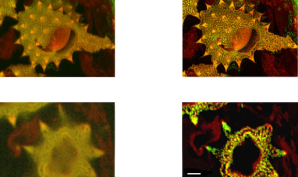 Detail at full resolution from image in A - surface clarity is enhanced as well as sharpness and resolution improvement in individual pollen grain