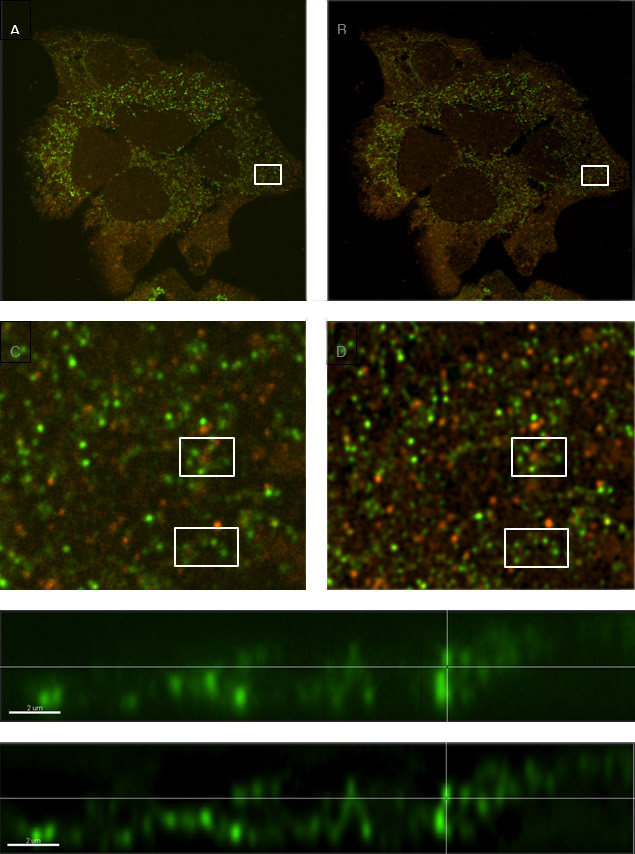 Comparison of a sample with labelled vesicles imaged using Dragonfly confocal mode and following ClearView-GPUTM deconvolution