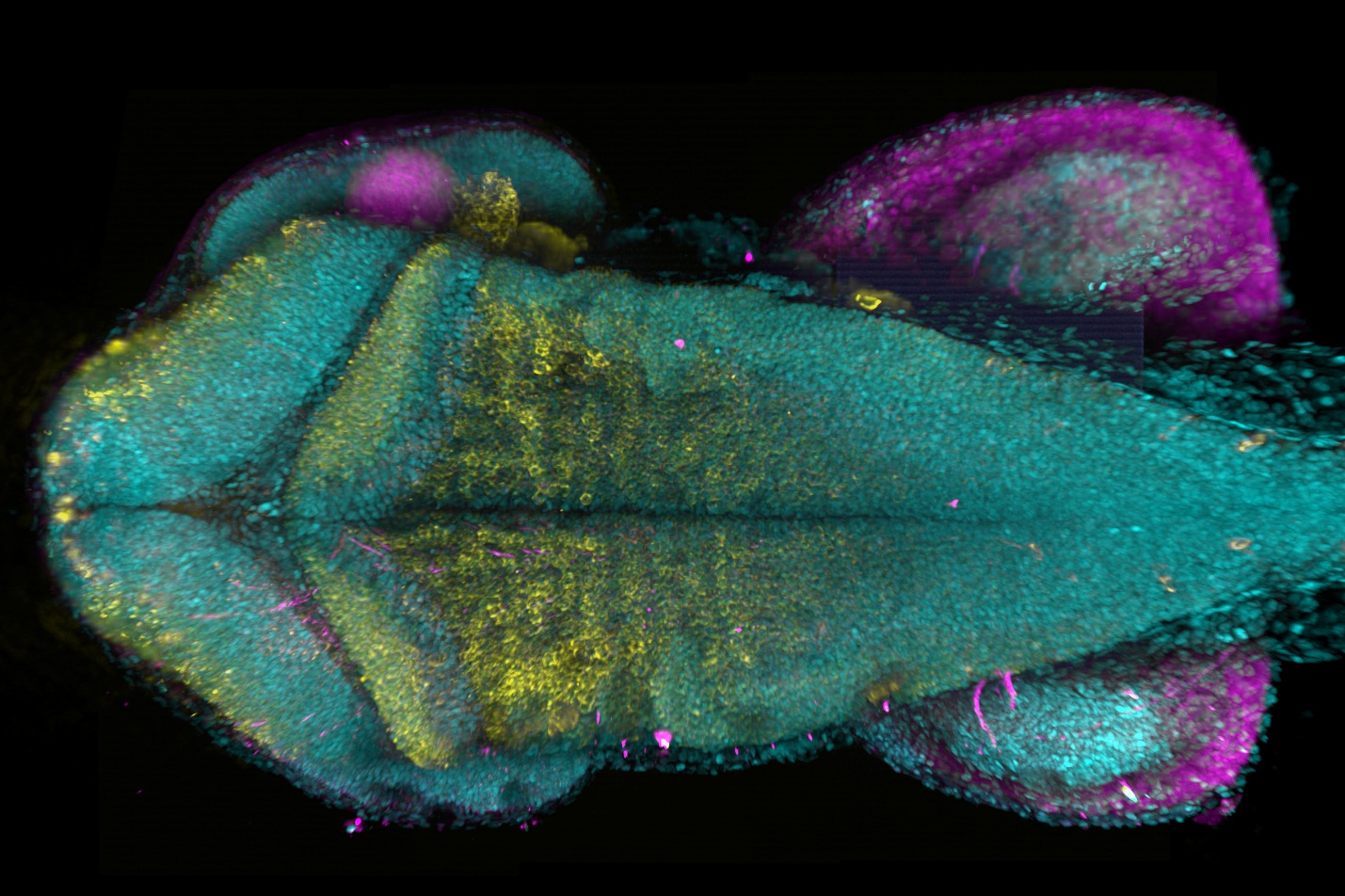 Image deep into the zebrafish brain with BC43 showing maximum projection of zebrafish hindbrain with neural and glial staining