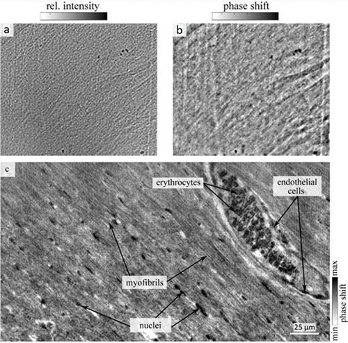 Figure 2a - Empty-beam and dark-field corrected projection, b - Phase reconstruction of the projection, c - Reconstructed tomographic 
                slice