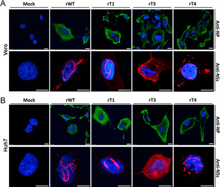 How to use Confocal Microscopy to Image Viruses? Andor Learning