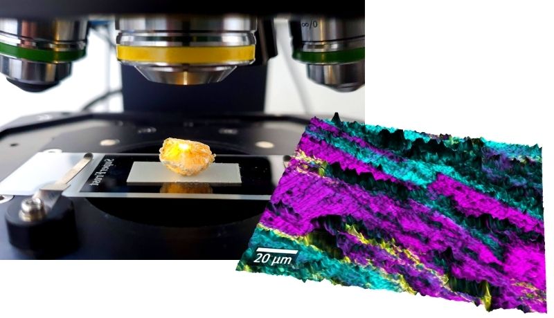 Topographic Raman imaging of a human gallstone