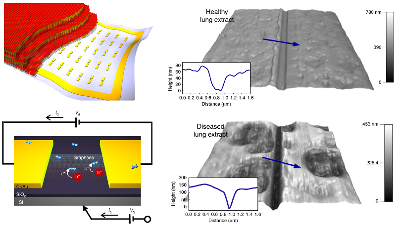 Schematics of graphene FET-based sensor and AFM topography images of healthy and diseased lung extracts