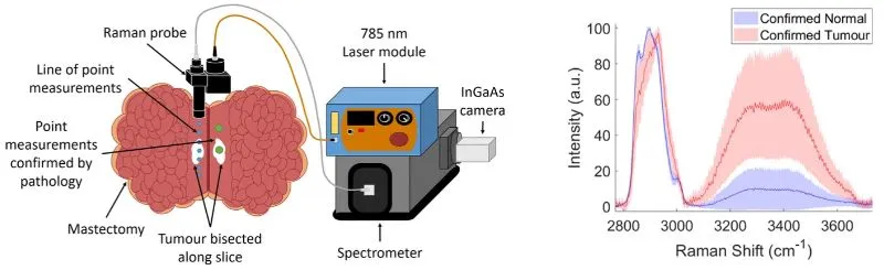 High-wavenumber Raman spectroscopy for distinguishing healthy and tumour breast tissue