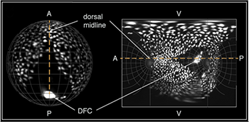 Spatial orientation of a Tg(Sox17:EGFP) embryo in 3D and on the final map projection