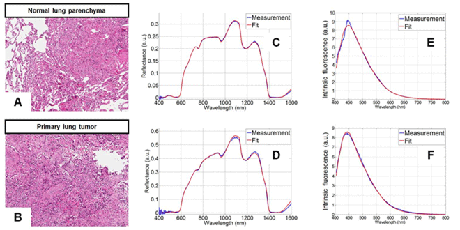 Typical DRS and FS spectra including fitted spectra from the models for both healthy and cancerous tissue