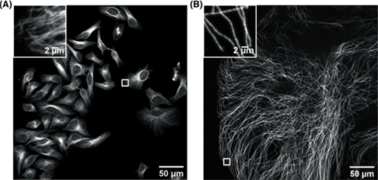 HeLa cells non expanded microtubules 