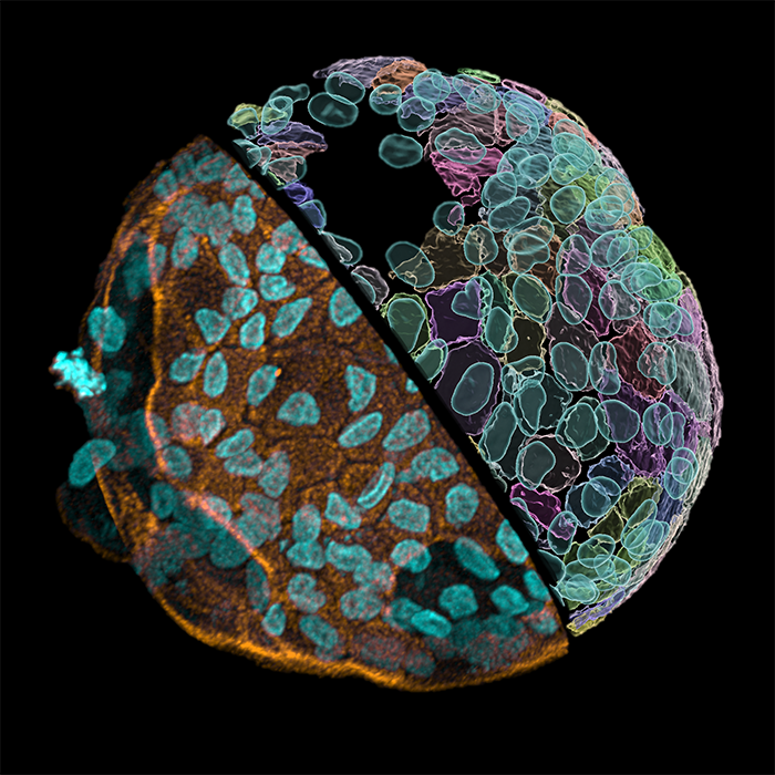 LPA Colonoid