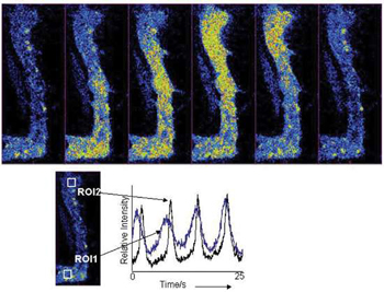 Ion Signalling Microscopy