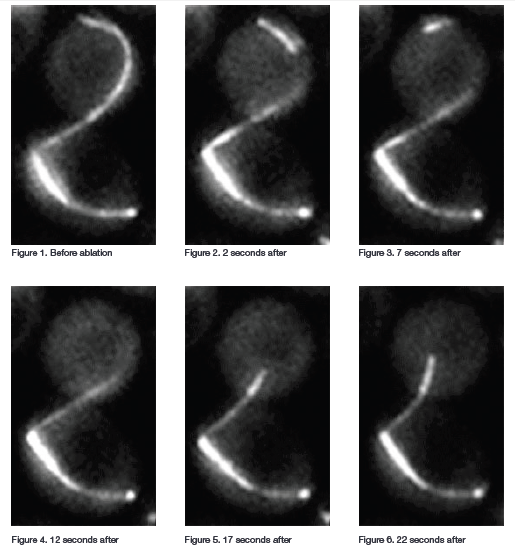 Laser Ablation