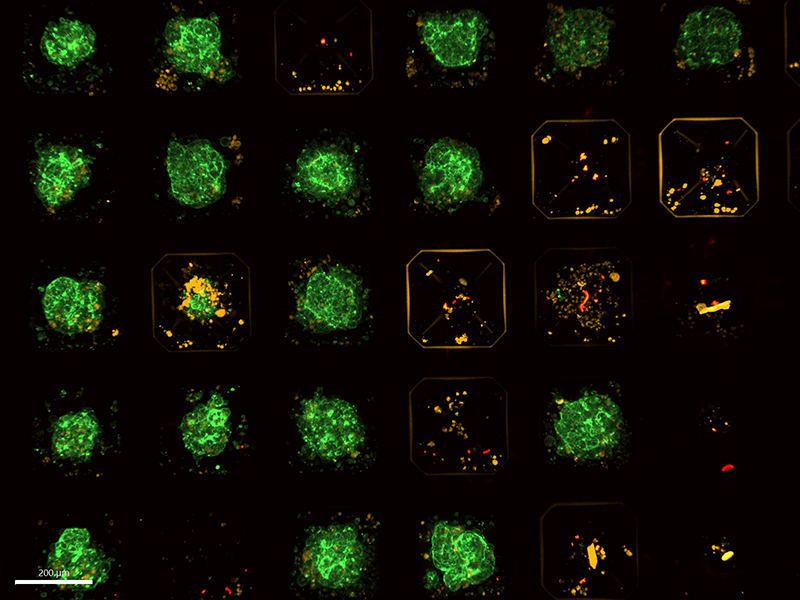 Organoids on chip