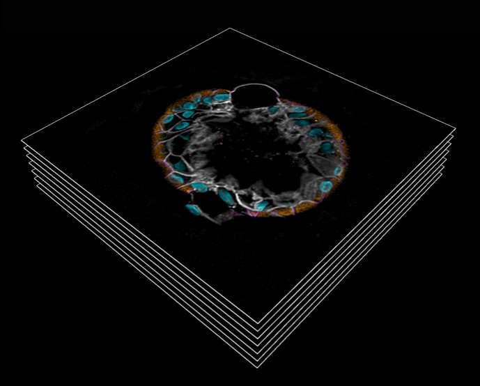 LPA organoid image stack