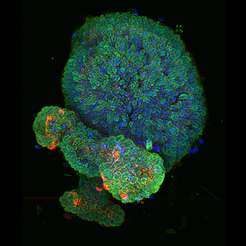 Staining- DNA (blue), LaminB1 (Green, nuclear envelope) and gamma-Tubilin (Red, centrosome).Sample type - Mouse Colonic Epithelial Organoid