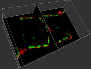 imaris spots tool stereology