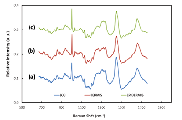 Typical Raman spectra acquired from BCC tissue, healthy tissue, dermis and epidermis