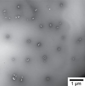 Transmission electron microscopy (TEM) image of vesicles from human urine