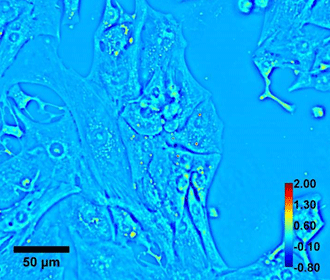 Quantitative phase imaging of Beating cardiomyocyte. Color bar shows phase in radian and scale bar is in micron