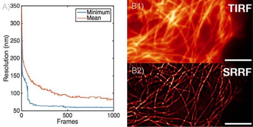 SRRF and SRRF-stream resolution increase with the number of frames acquired (and processed) per time point.