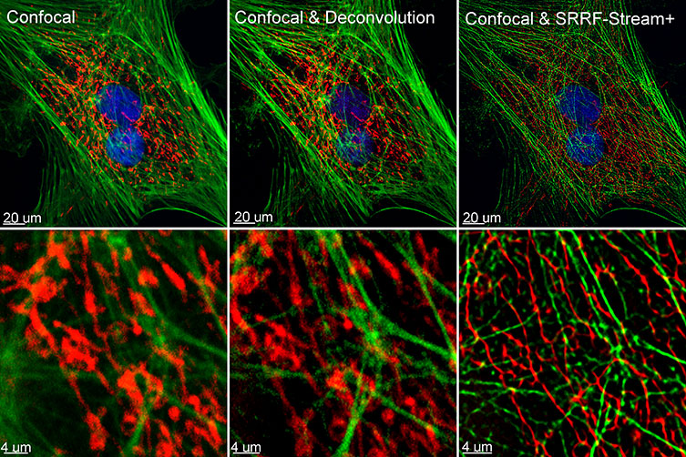 Comparison between confocal imaging, confocal imaging & deconvolution and confocal imaging & SRRF-stream+