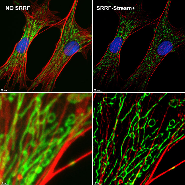 SRRF-Stream+ delivers High-quality Super-resolved images.