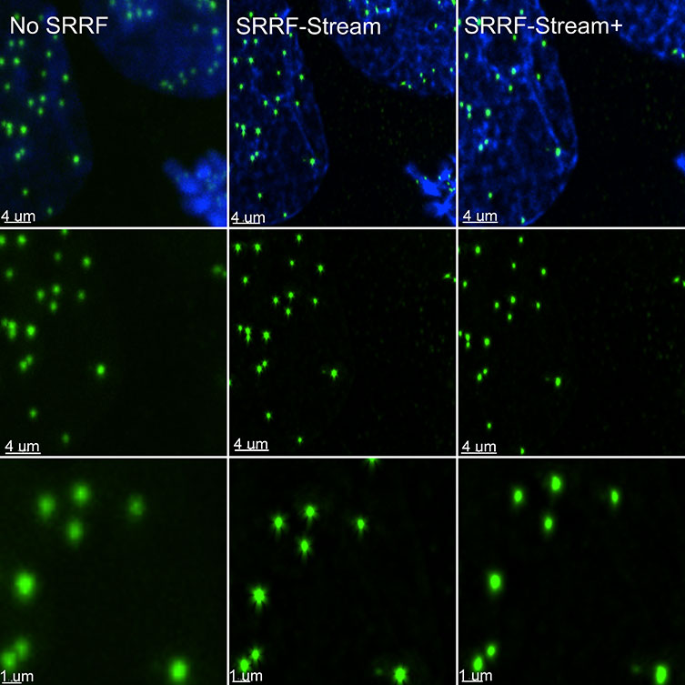 SRRF stream+ delivers high-quality data. 