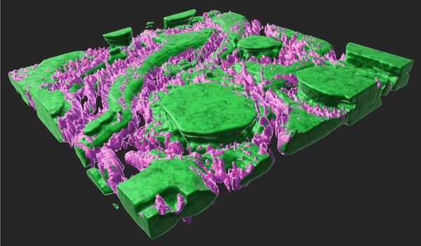 3D THG image of subcutaneous tissue