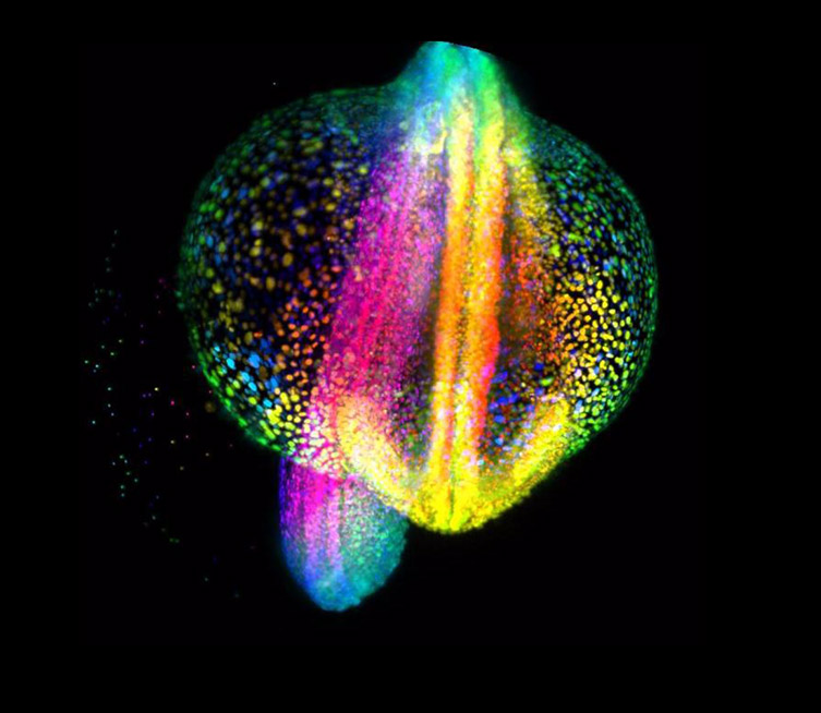 Light Sheet Microscopy Spim Is It