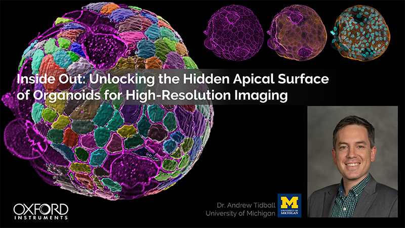 Organoid Webinar Teaser