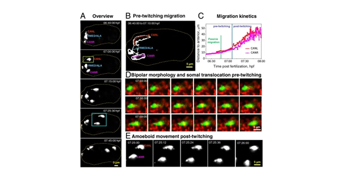Using Inverted SPIM (iSPIM) to study neural development. — Oxford ...